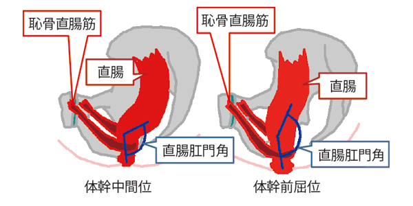 図２）骨盤の傾斜と恥骨直腸筋よる直腸肛門角の変化