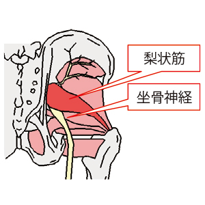 図１）梨状筋と坐骨神経