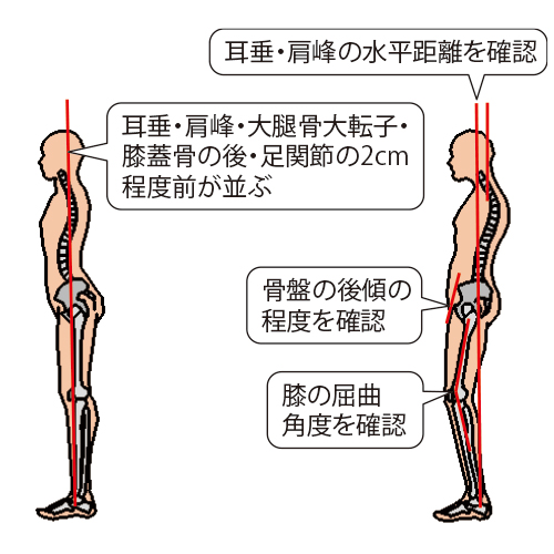図1）立位姿勢での確認ポイント